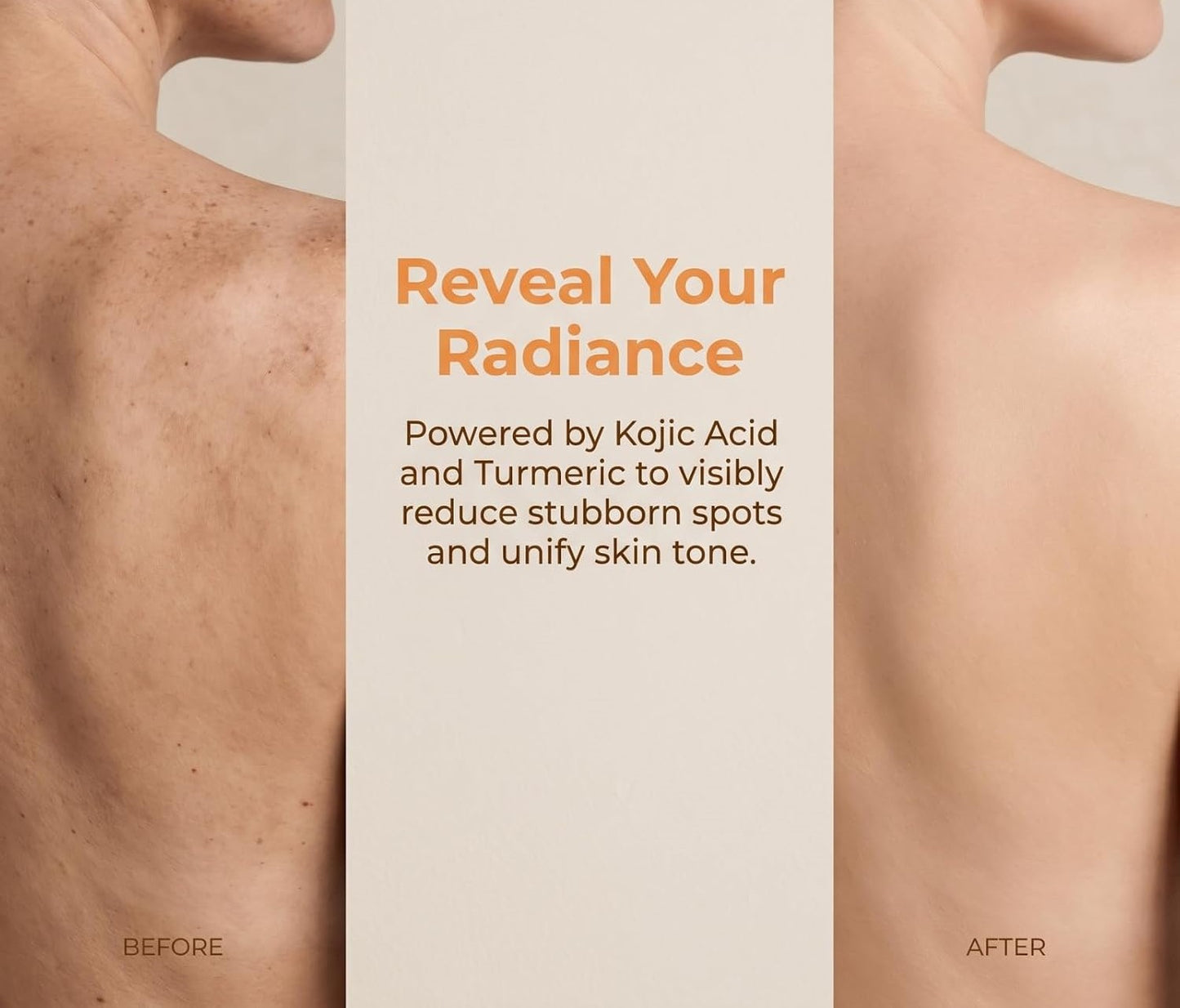 ⚡ Flash Sale | Kojic Acid - Turmeric Exfoliating Body Mist | Smooth Skin & Pore Care
